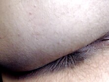 Butthole Extraordinary Closeup Hirsute Red Fingernails