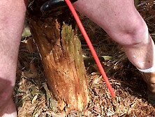 Outdoor neon catheter insertion