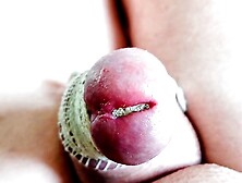 Urethra stretching.