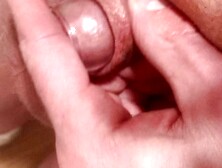 Ways to stretch and regain some foreskin