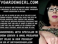 Dirtygardengirl With Speculum In Snatch Show Cervix And Anal Prolapse & Put Dildo In Her Peehole