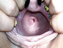 Nubile,  Cervix,  Close